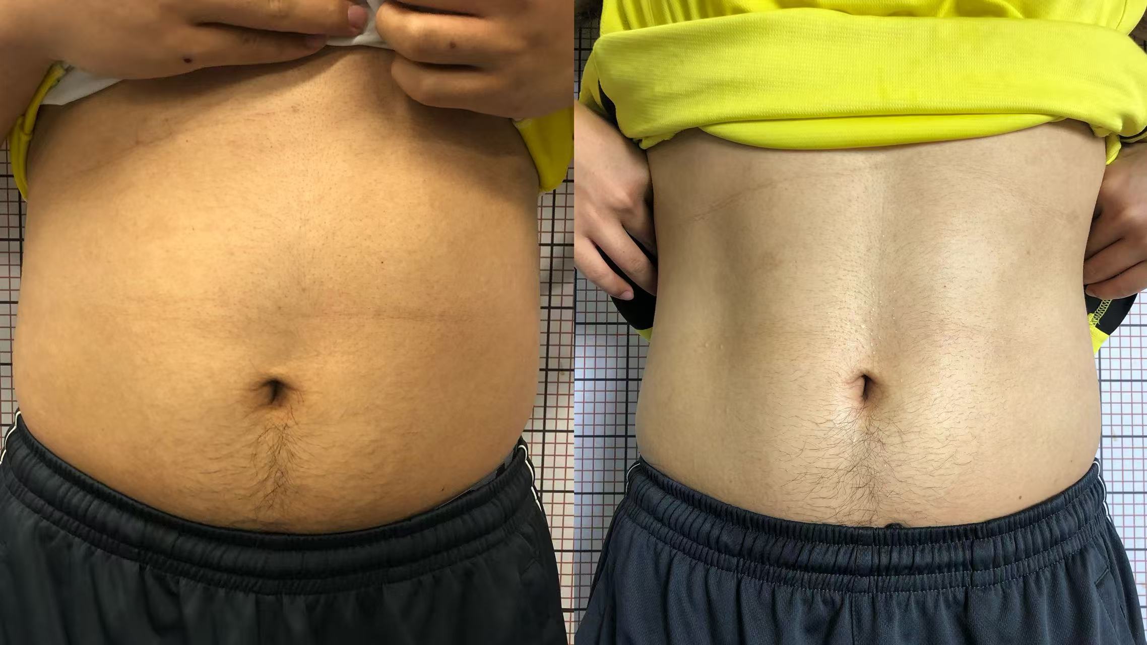 前后对比案例展示